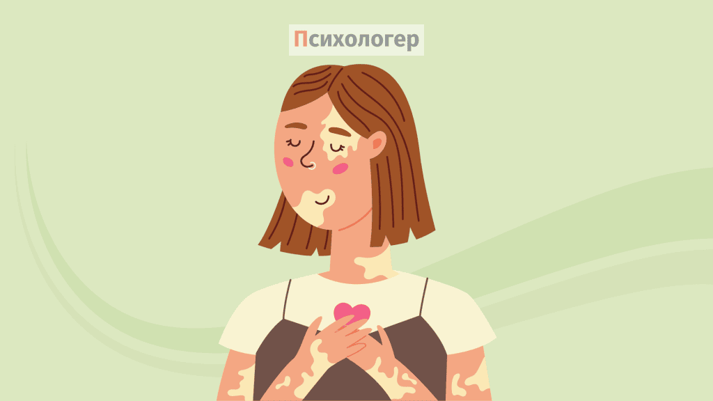 Самоприйняття