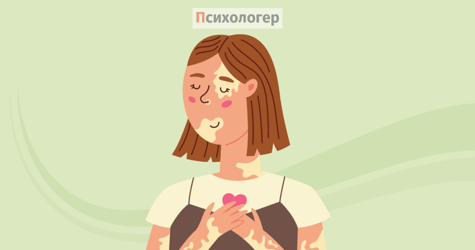 Самоприйняття